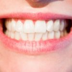 Aktualna technika stosowana w salonach stomatologii estetycznej zdoła spowodować, że odzyskamy ładny uśmiech.